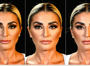 Зірка реаліті-шоу Емма Фернлунд перенесла три пластичні операції в Туреччині для досягнення "ідеального обличчя"