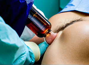 Штучний інтелект у медицині