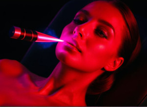 Зірка реаліті-ТВ Івонн Вёльке перенесла болючу лазерну процедуру заради коханого