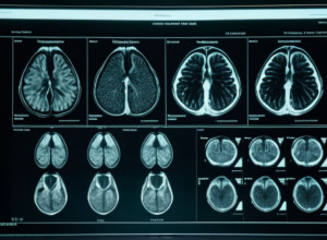 Здоров'я Трампа: Офіційні результати МРТ підтверджують "відмінний стан"