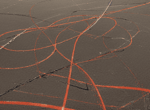 Жахлива травма гандболіста: вивих руки