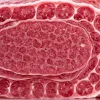 REWE відкликає небезпечну салямі: бактерії E. coli можуть спричинити ниркову недостатність