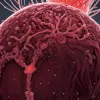 Сепсис: Смертельна загроза, небезпечніша за інфаркт – кожна п'ята смерть у світі пов'язана із зараженням крові